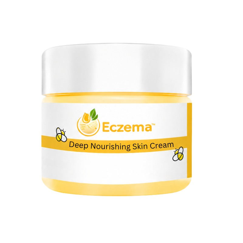 Eczema™