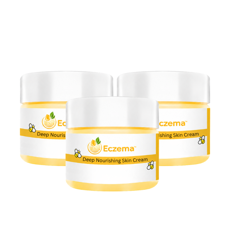 Eczema™